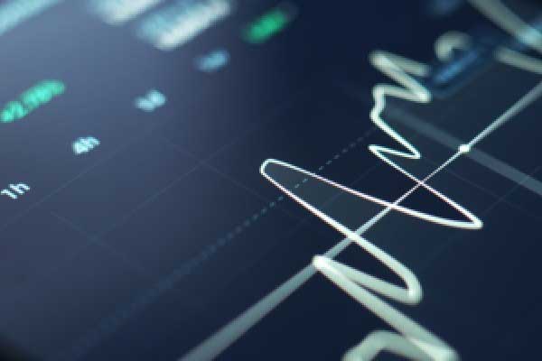 3月28日澳元兑美元走势分析(2025年03月28日)